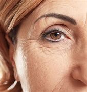 Aging/Wrinkles